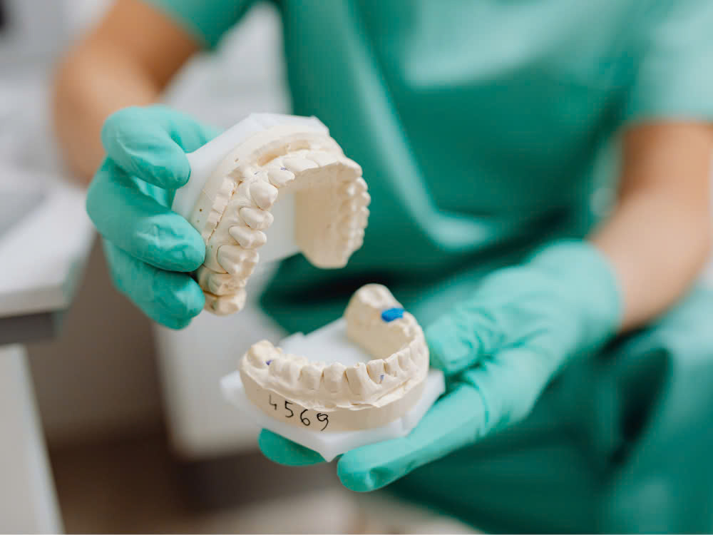 Trồng răng implant